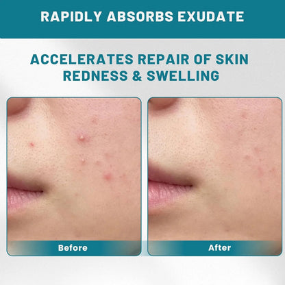 Hydrocolloid Wound Care Roll – Cut-to-Size Bandage