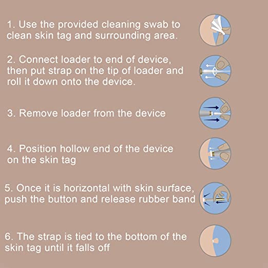 PAINLESS AUTO SKIN TAG  REMOVER KIT™