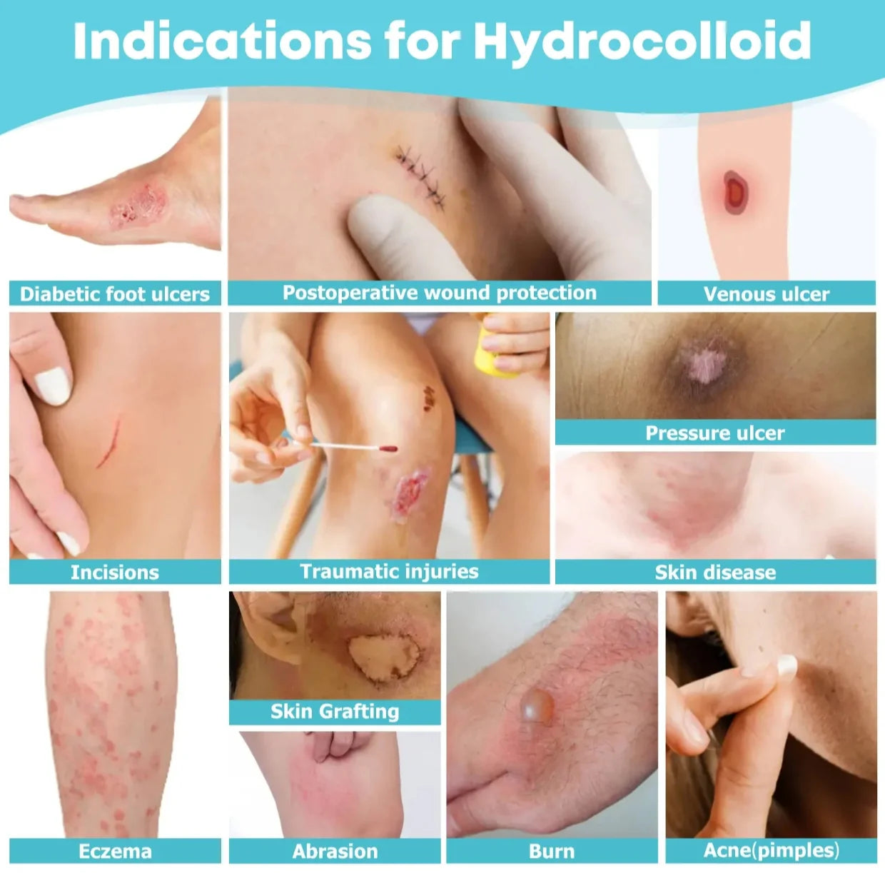 Hydrocolloid Wound Care Roll – Cut-to-Size Bandage