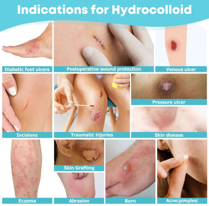 Hydrocolloid Wound Care Roll – Cut-to-Size Bandage