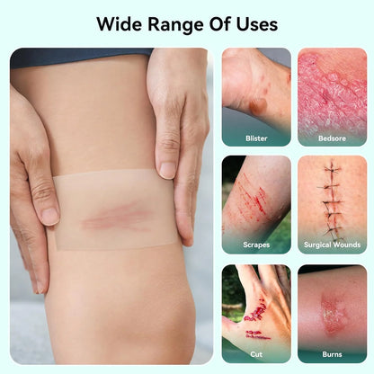 Hydrocolloid Wound Care Roll – Cut-to-Size Bandage