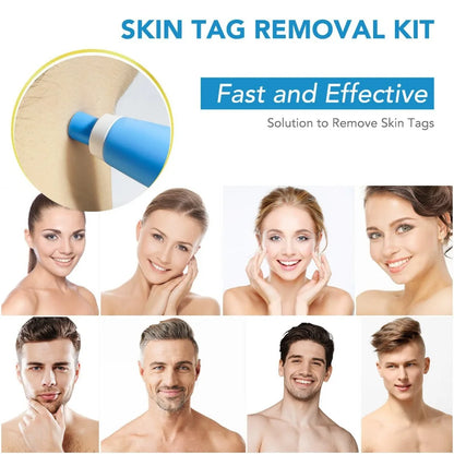 PAINLESS AUTO SKIN TAG  REMOVER KIT™